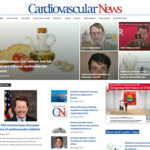 CVN digital
